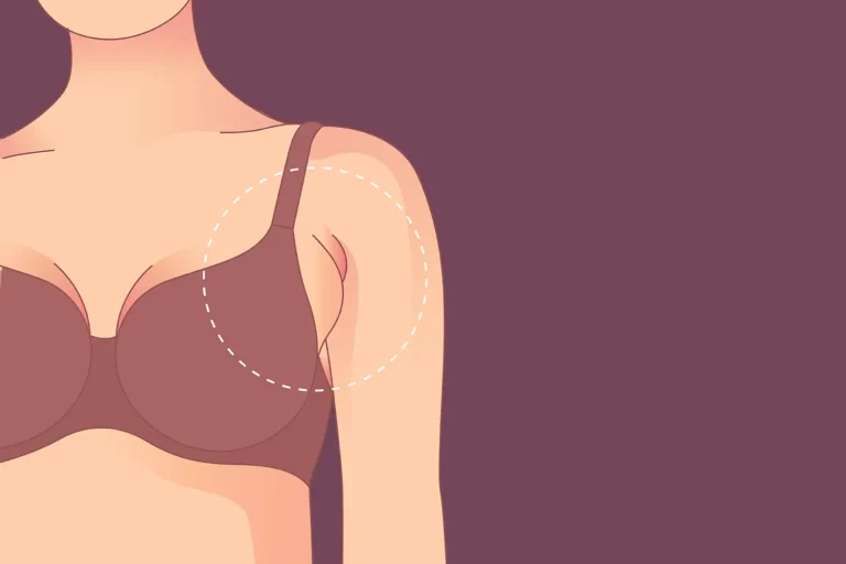 Bra fitting blunders: common mistakes and how to avoid them